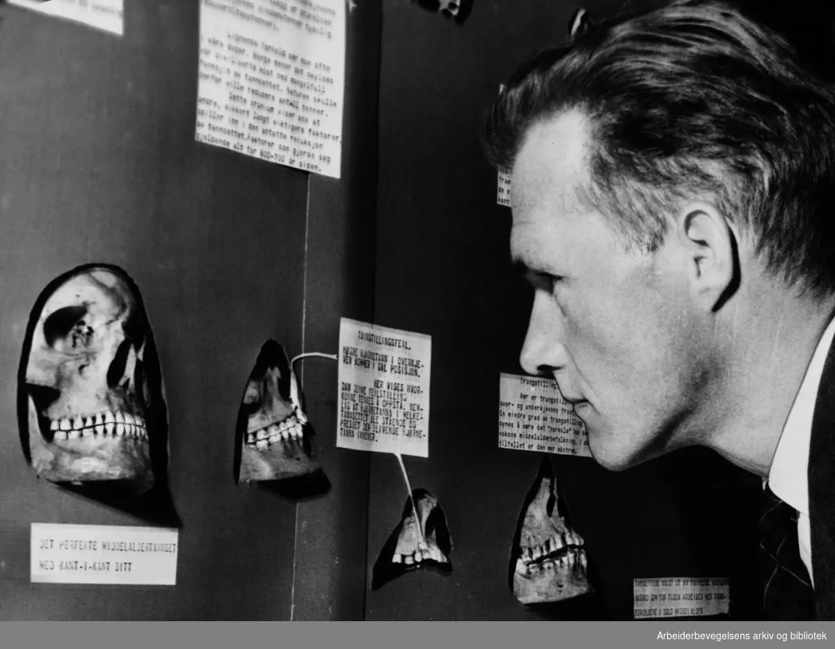 Sivilingeniør Thomas Eeg-Henriksen studerer tannstillinger på hodeskaller fra middelalderen i avdelingen for Fysisk Antropologi ved Anatomisk Institutt. Juni 1961