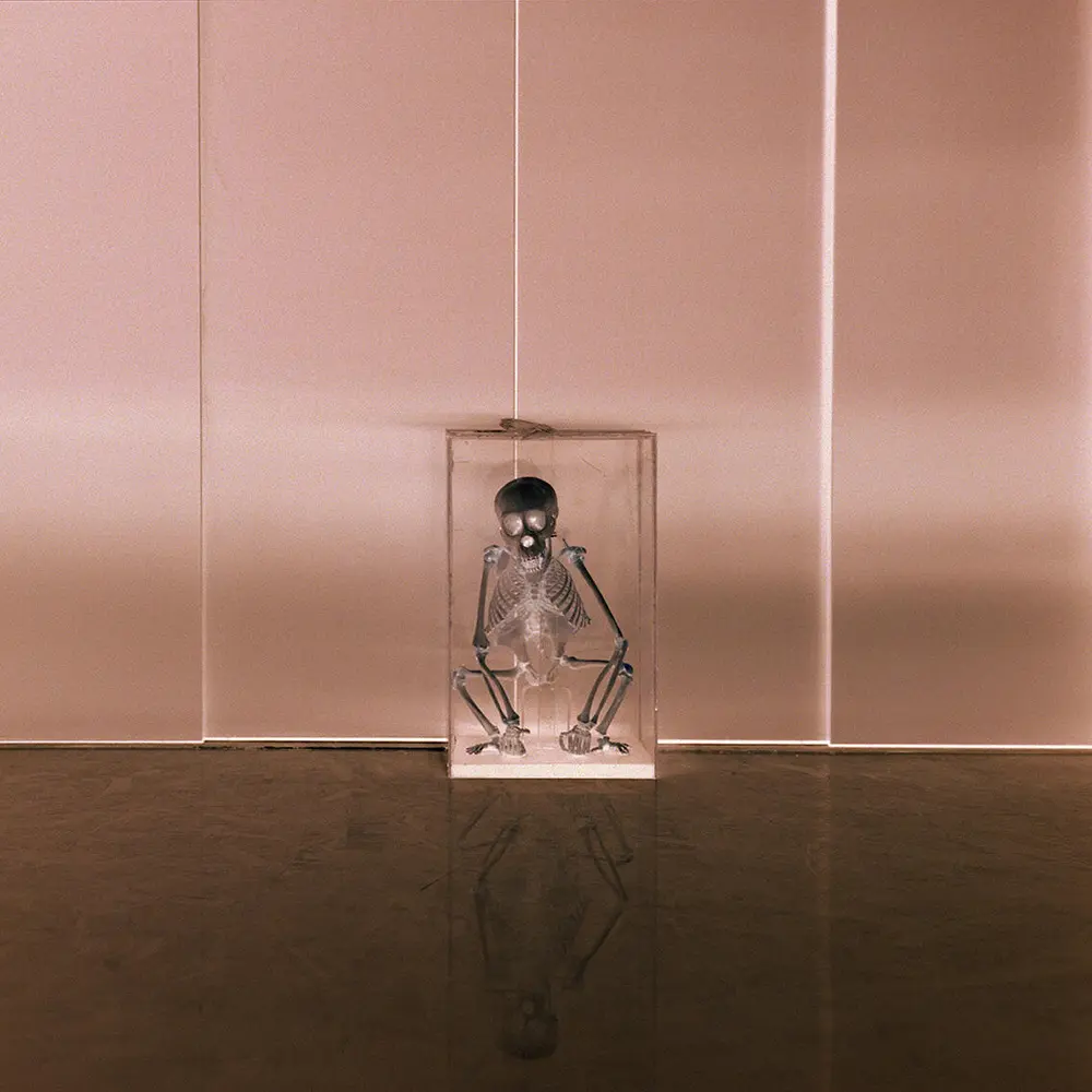 Image of a glass case with the skeleton of a small monkey. The image is negative, with a rose tint. Photograph.