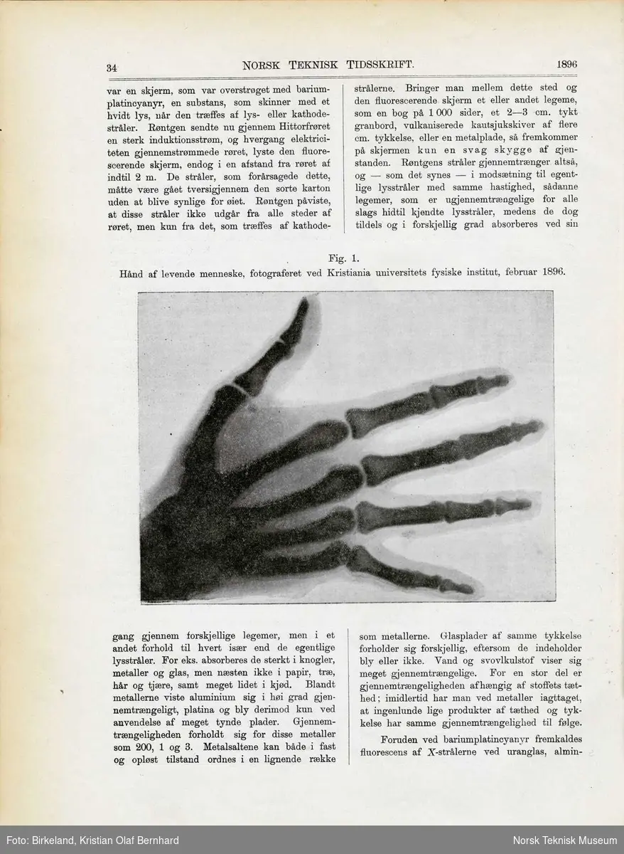 Det første røntgenfotografi tatt i Norge. Professor Torups hånd fotografert av Kristian Birkeland i februar 1896. Eksponeringstid: 5 min.