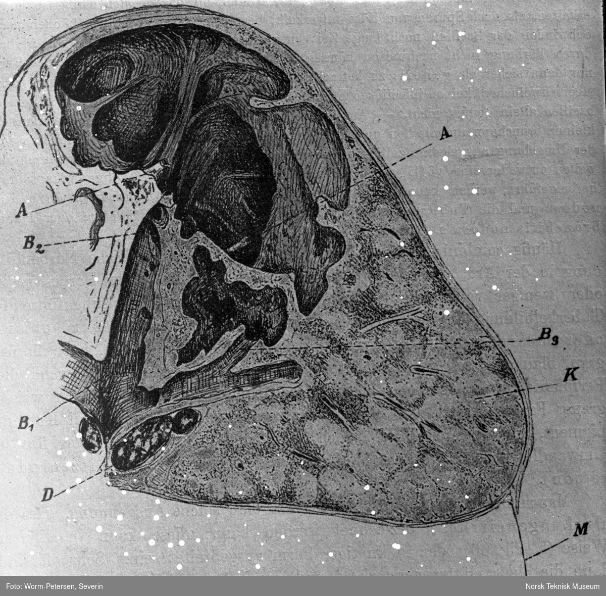 Anatomi, illustrasjon. Caverner