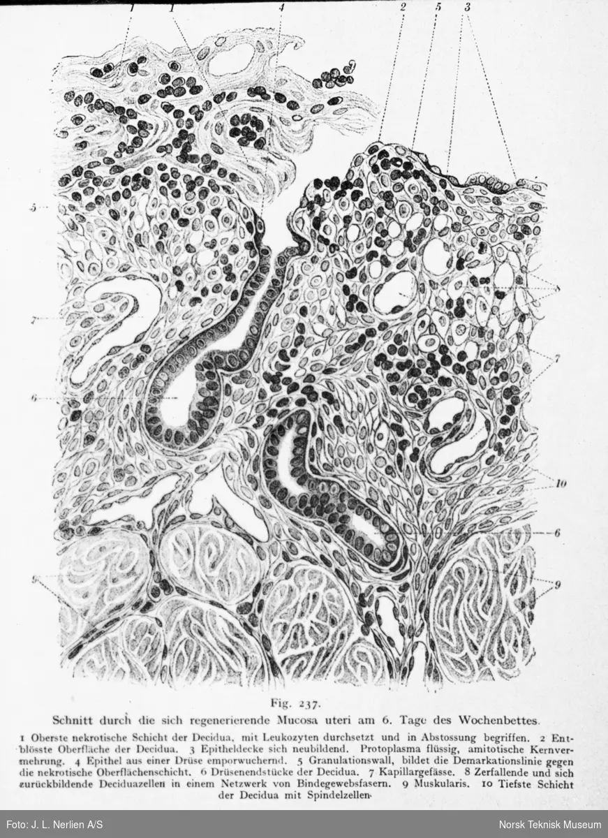Avfotografert tegning av et mikroskopibilde av den regenererende livmorslimhinnen på den 6. dagen etter fødsel