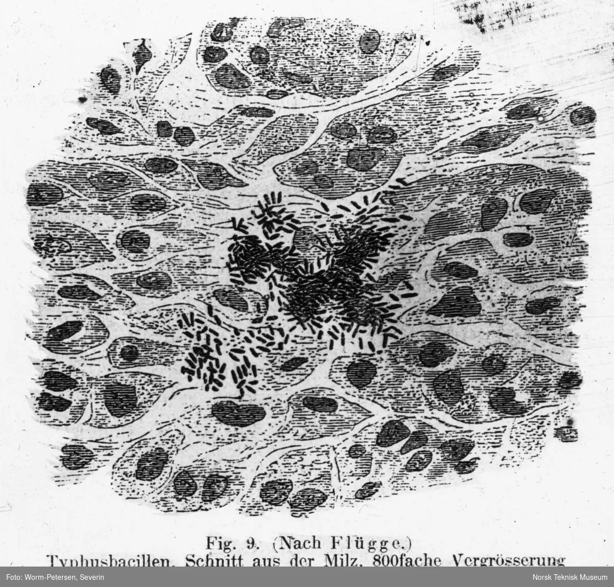 Typhusbasillen, snitt gjennom milten
