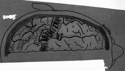 Dr. Magnus (Hjernen)