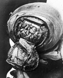 Dr. Magnus (Hjernen)