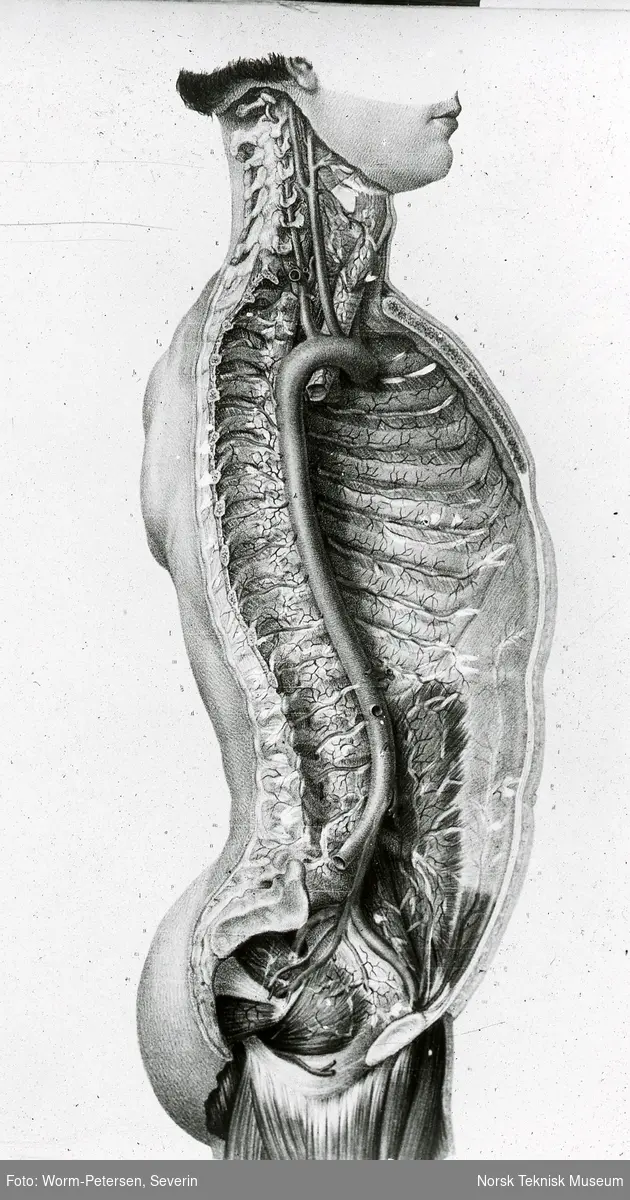 Anatomisk snitttegning av overkroppen, sett fra siden, delt langs ryggsøylen (umontert glass-dias)