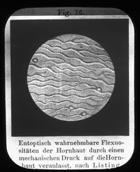 Anatomi; Øyet. Hornhuden.