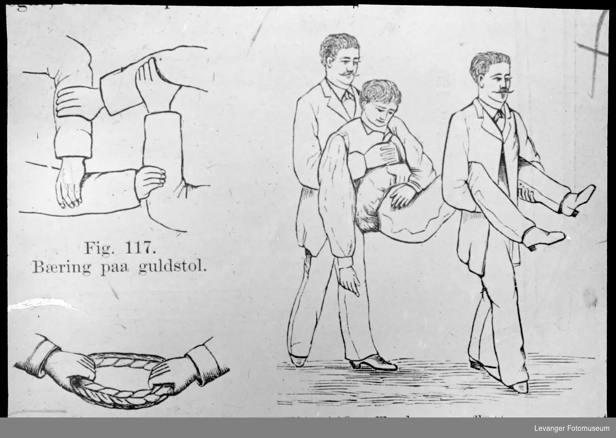 Tegning fra medisinsk håndbok håndbok, viset teknikk med gull-stol.